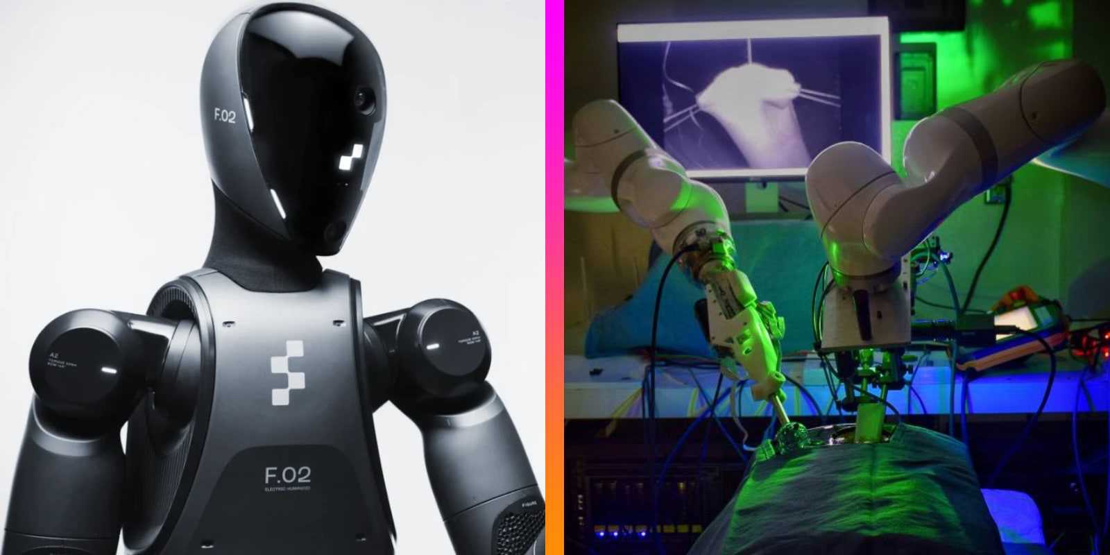Budúcnosť je tu: Robot s umelou inteligenciou odoperoval zákrok bez chyby, chirurgovia len mlčky sledovali