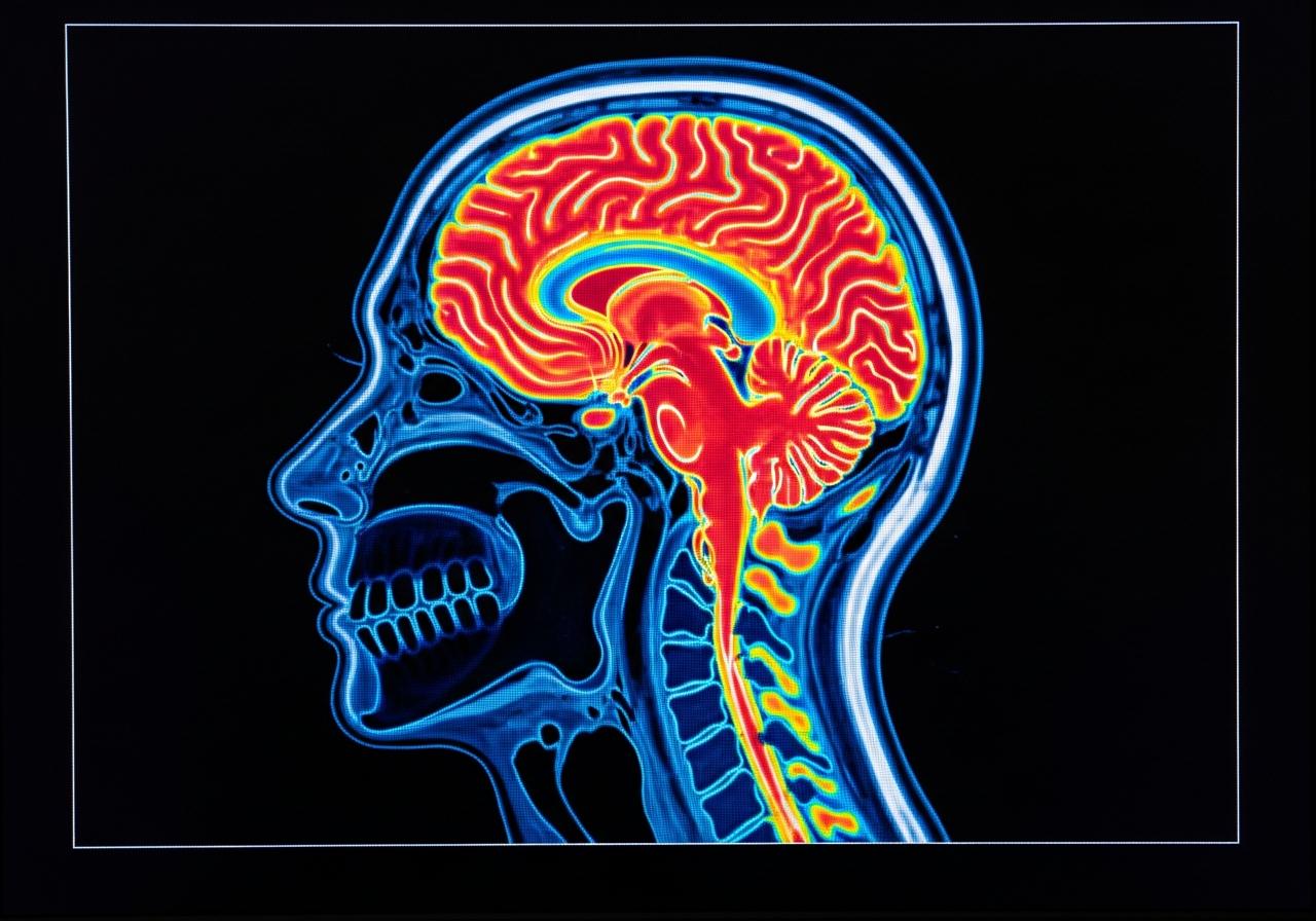 Puberta mozgu trvá až do 32 rokov: Vedci určili päť kľúčových etáp života